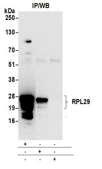 Immunoprecipitation:[NBP3-29018]-Detection of human RPL29 by western blot of immunoprecipitates. Samples: Whole cell lysate from 293T cells prepared using NETN lysis buffer. Antibodies: Affinity purified rabbit anti-RPL29 antibody used for IP at 6 µg per reaction. RPL29 was also immunoprecipitated by rabbit anti-RPL29 antibody. For blotting immunoprecipitated RPL29, was used at 0. 4 µg/ml. Detection: Chemiluminescence with an exposure time of 30 seconds.