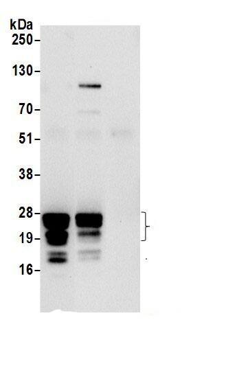 Immunoprecipitation:RPL29 AntibodyNBP3-29019] -Detection of human RPL29 by western blot of immunoprecipitates. Samples: Whole cell lysate (0.5 or 1.0 mg per IP reaction; 20% of IP loaded) from 293T cells prepared using NETN lysis buffer. Antibodies: Affinity purified rabbit anti-RPL29 antibody NBP3-29019 (lot NBP3-29019-1) used for IP at 6 µg per reaction. RPL29 was also immunoprecipitated by rabbit anti-RPL29 antibody. For blotting immunoprecipitated RPL29, NBP3-29019 was used at 0.4 µg/ml. Detection: Chemiluminescence with an exposure time of 10 seconds.