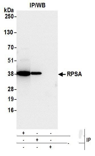 Immunoprecipitation:[NBP3-29021]-Detection of human RPSA by western blot of immunoprecipitates. Samples: Whole cell lysate from 293T cells prepared using NETN lysis buffer. Antibodies: Affinity purified rabbit antibody used for IP at 6 µg per reaction. RPSA was also immunoprecipitated by rabbit antibody. For blotting immunoprecipitated RPSA, was used at 1 µg/ml. Detection: Chemiluminescence with an exposure time of 10 seconds.