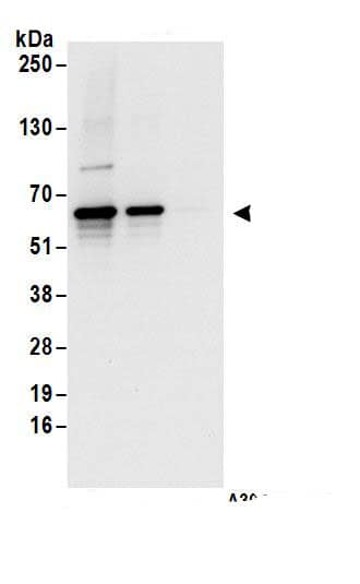 Immunoprecipitation:EDC3 AntibodyNBP3-29025] -Detection of human EDC3 by western blot of immunoprecipitates. Samples: Whole cell lysate (1 mg for IP; 20% of IP loaded) from HEK293T cells. Antibodies: Affinity purified rabbit anti-EDC3 antibody NBP3-29025 (lot NBP3-29025-1) used for IP at 6 µg/mg lysate. EDC3 was also immunoprecipitated by rabbit anti-EDC3 antibody. For blotting immunoprecipitated EDC3, NBP3-29025 was used at 1 µg/ml. Detection: Chemiluminescence with an exposure time of 10 seconds.
