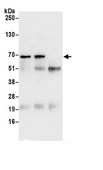 Immunoprecipitation:SPATS2 AntibodyNBP3-29029] -Detection of human SPATS2 by western blot of immunoprecipitates. Samples: Whole cell lysate (0.5 or 1.0 mg per IP reaction; 20% of IP loaded) from HeLa cells prepared using NETN lysis buffer. Antibodies: Affinity purified rabbit anti-SPATS2 antibody NBP3-29029 (lot NBP3-29029-1) used for IP at 6 µg per reaction. SPATS2 was also immunoprecipitated by rabbit anti-SPATS2 antibody. For blotting immunoprecipitated SPATS2, NBP3-29029 was used at 1 µg/ml. Detection: Chemiluminescence with an exposure time of 3 minutes.