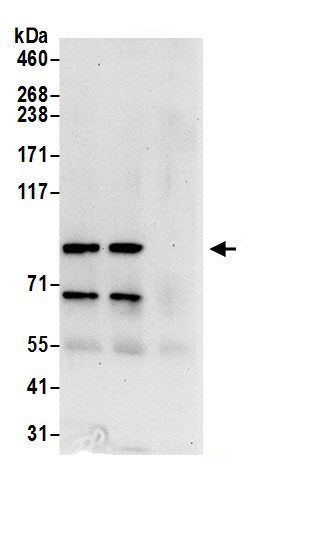 Immunoprecipitation:Centaurin beta 2 AntibodyNBP3-29037] -Detection of human ACAP2 by western blot of immunoprecipitates. Samples: Whole cell lysate (0.5 or 1.0 mg per IP reaction; 20% of IP loaded) from 293T cells prepared using NETN lysis buffer. Antibodies: Affinity purified rabbit anti-ACAP2 antibody NBP3-29037 (lot NBP3-29037-1) used for IP at 6 µg per reaction. ACAP2 was also immunoprecipitated by rabbit anti-ACAP2 antibody. For blotting immunoprecipitated ACAP2, NBP3-29037 was used at 1 µg/ml. Detection: Chemiluminescence with an exposure time of 30 seconds.