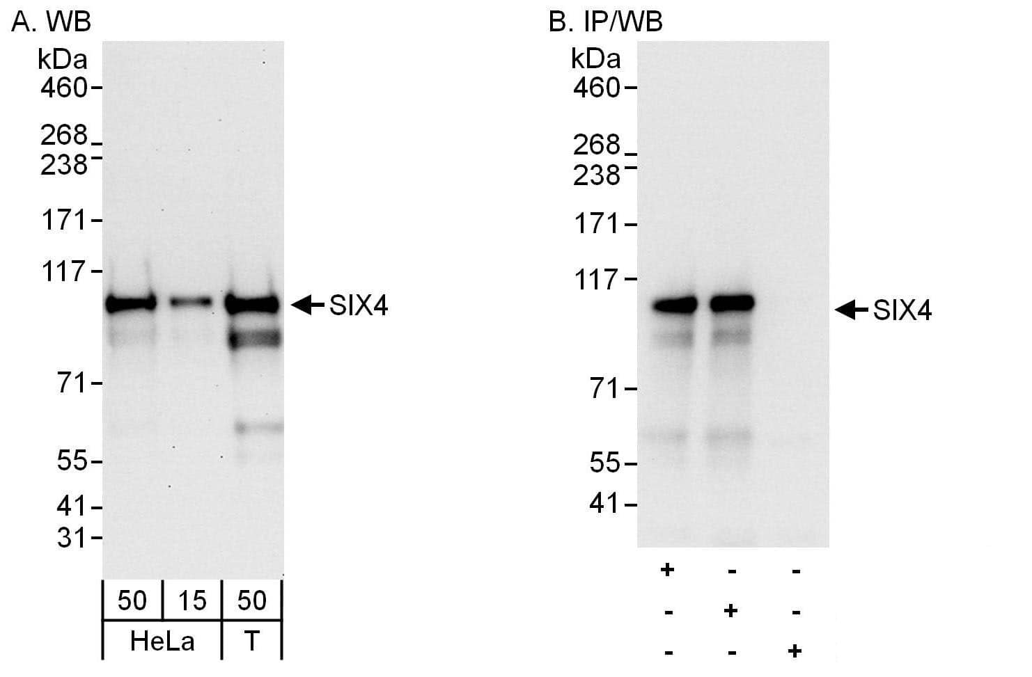 Western Blot:[NBP3-29038]-Detection of human SIX4 by western blot and immunoprecipitation. Samples: Whole cell lysate from HeLa and HEK293T cells. Antibodies: Affinity purified rabbit anti-SIX4 antibody used for WB at 0. 04 µg/ml and 0. 4 µg/ml and used for IP at 6 µg/mg lysate. SIX4 was also immunoprecipitated by rabbit anti-SIX4 antibody , which recognizes an upstream epitope. Detection: Chemiluminescence with exposure times of 30 seconds and 3 seconds.