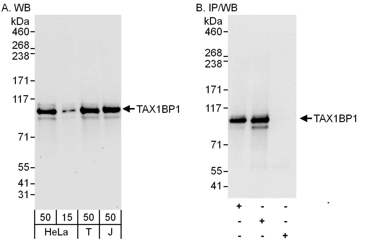 Western Blot:[NBP3-29039]-Detection of human TAX1BP1 by western blot and immunoprecipitation. Samples: Whole cell lysate from HeLa , HEK293T and Jurkat cells. Antibodies: Affinity purified rabbit anti-TAX1BP1 antibody used for WB at 0. 1 µg/ml and 1 µg/ml and used for IP at 6 µg/mg lysate. TAX1BP1 was also immunoprecipitated by rabbit anti-TAX1BP1 antibody , which recognizes an upstream epitope. Detection: Chemiluminescence with exposure times of 30 seconds and 10 seconds.