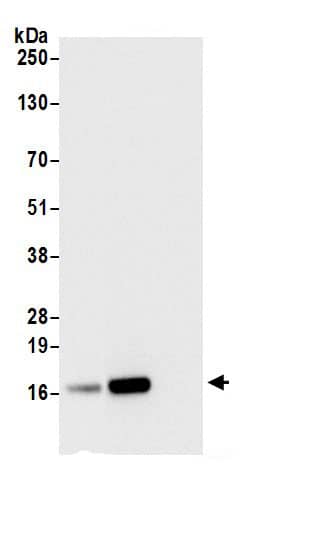 Immunoprecipitation:RPL21 AntibodyNBP3-29043] -Detection of human RPL21 by western blot of immunoprecipitates. Samples: Whole cell lysate (0.5 or 1.0 mg per IP reaction; 20% of IP loaded) from 293T cells prepared using NETN lysis buffer. Antibodies: Affinity purified rabbit anti-RPL21 antibody NBP3-29043 (lot NBP3-29043-1) used for IP at 6 µg per reaction. RPL21 was also immunoprecipitated by rabbit anti-RPL21 antibody. For blotting immunoprecipitated RPL21, NBP3-29043 was used at 1 µg/ml. Detection: Chemiluminescence with an exposure time of 1 second.