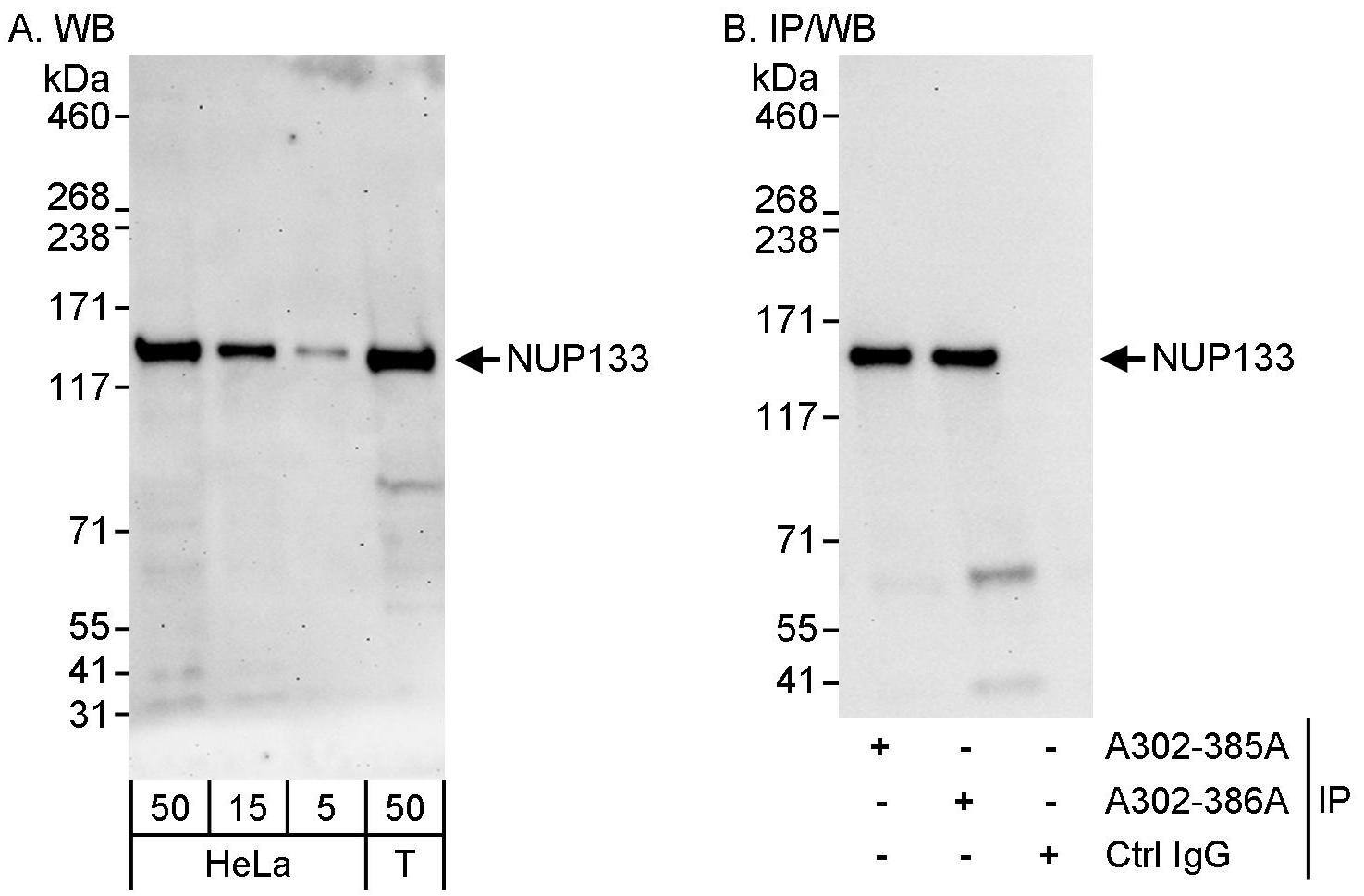 Western Blot:[NBP3-29044]-Detection of human NUP133 by western blot and immunoprecipitation. Samples: Whole cell lysate from HeLa and HEK293T cells. Antibodies: Affinity purified rabbit anti-NUP133 antibody used for WB at 0. 04 µg/ml and 1 µg/ml and used for IP at 10 µg/mg lysate. NUP133 was also immunoprecipitated by rabbit anti-NUP133 antibody , which recognizes an upstream epitope. Detection: Chemiluminescence with exposure times of 3 minutes and 10 seconds.