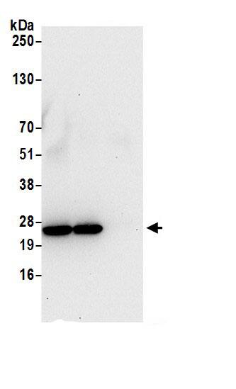 Immunoprecipitation:HSPC111 AntibodyNBP3-29045] -Detection of human NOP16 by western blot of immunoprecipitates. Samples: Whole cell lysate (0.5 or 1.0 mg per IP reaction; 20% of IP loaded) from HeLa cells prepared using NETN lysis buffer. Antibodies: Affinity purified rabbit anti-NOP16 antibody NBP3-29045 (lot NBP3-29045-1) used for IP at 6 µg per reaction. NOP16 was also immunoprecipitated by rabbit anti-NOP16 antibody. For blotting immunoprecipitated NOP16, NBP3-29045 was used at 0.4 µg/ml. Detection: Chemiluminescence with an exposure time of 30 seconds.