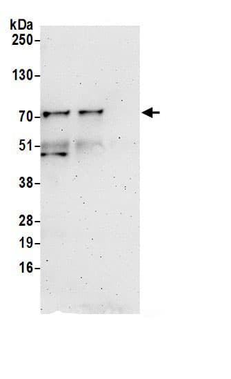 Immunoprecipitation:RPUSD2 AntibodyNBP3-29046] -Detection of human RPUSD2 by western blot of immunoprecipitates. Samples: Whole cell lysate (0.5 or 1.0 mg per IP reaction; 20% of IP loaded) from HeLa (15µg) cells prepared using NETN lysis buffer. Antibodies: Affinity purified rabbit anti-RPUSD2 antibody NBP3-29046 (lot NBP3-29046-1) used for IP at 6 µg per reaction. RPUSD2 was also immunoprecipitated by rabbit anti-RPUSD2 antibody. For blotting immunoprecipitated RPUSD2, NBP3-29046 was used at 1 µg/ml. Detection: Chemiluminescence with an exposure time of 3 minutes.