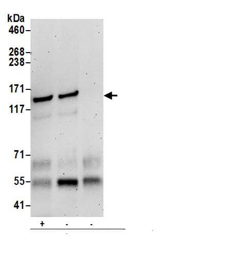 Immunoprecipitation:VARS AntibodyNBP3-29048] -Detection of human Valyl-tRNA Synthetase/VARS by western blot of immunoprecipitates. Samples: Whole cell lysate (0.5 or 1.0 mg per IP reaction; 20% of IP loaded) from 293T cells prepared using NETN lysis buffer. Antibodies: Affinity purified rabbit anti-Valyl-tRNA Synthetase/VARS antibody NBP3-29048 (lot NBP3-29048-1) used for IP at 6 µg per reaction. Valyl-tRNA Synthetase/VARS was also immunoprecipitated by rabbit anti-Valyl-tRNA Synthetase/VARS antibody . For blotting immunoprecipitated Valyl-tRNA Synthetase/VARS, NBP3-29048 was used at 0.4 µg/ml. Detection: Chemiluminescence with an exposure time of 3 minutes.