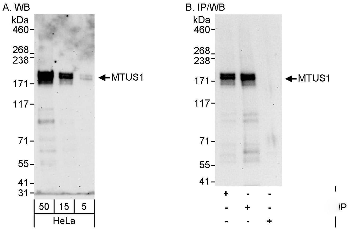 Western Blot:[NBP3-29050]-Detection of human MTUS1 by western blot and immunoprecipitation. Samples: Whole cell lysate from HeLa cells. Antibodies: Affinity purified rabbit anti-MTUS1 antibody used for WB at 0. 4 µg/ml and 1 µg/ml and used for IP at 3 µg/mg lysate. MTUS1 was also immunoprecipitated by rabbit anti-MTUS1 antibody , which recognizes an upstream epitope. Detection: Chemiluminescence with exposure times of 3 minutes and 30 seconds.
