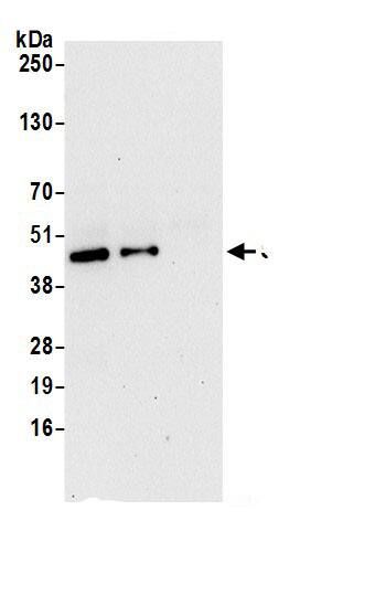 Immunoprecipitation:SUCLG2 AntibodyNBP3-29051] -Detection of human SUCLG2 by western blot of immunoprecipitates. Samples: Whole cell lysate (0.5 or 1.0 mg per IP reaction; 20% of IP loaded) from 293T cells prepared using NETN lysis buffer. Antibodies: Affinity purified rabbit anti-SUCLG2 antibody NBP3-29051 (lot NBP3-29051-1) used for IP at 6 µg per reaction. SUCLG2 was also immunoprecipitated by rabbit anti-SUCLG2.. For blotting immunoprecipitated SUCLG2, NBP3-29051 was used at 1 µg/ml. Detection: Chemiluminescence with an exposure time of 30 seconds.