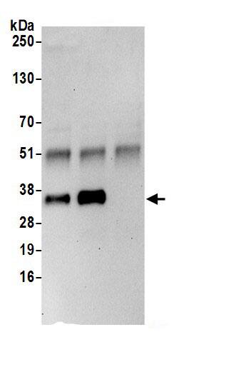 Immunoprecipitation:PPA2 AntibodyNBP3-29052] -Detection of human PPA2 by western blot of immunoprecipitates. Samples: Whole cell lysate (0.5 or 1.0 mg per IP reaction; 20% of IP loaded) from Jurkat cells prepared using NETN lysis buffer. Antibodies: Affinity purified rabbit anti-PPA2 antibody NBP3-29052 (lot NBP3-29052-1) used for IP at 6 µg per reaction. PPA2 was also immunoprecipitated by rabbit anti-PPA2.. For blotting immunoprecipitated PPA2, NBP3-29052 was used at 1 µg/ml. Detection: Chemiluminescence with an exposure time of 30 seconds.