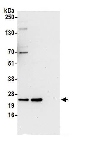 Immunoprecipitation:Biliverdin Reductase B/BLVRB AntibodyNBP3-29053] -Detection of human BLVRB by western blot of immunoprecipitates. Samples: Whole cell lysate (0.5 or 1.0 mg per IP reaction; 20% of IP loaded) from 293T cells prepared using NETN lysis buffer. Antibodies: Affinity purified rabbit anti-BLVRB antibody NBP3-29053 (lot NBP3-29053-1) used for IP at 6 µg per reaction. BLVRB was also immunoprecipitated by rabbit anti-BLVRB Antibody.. For blotting immunoprecipitated BLVRB, NBP3-29053 was used at 1 µg/ml. Detection: Chemiluminescence with an exposure time of 30 seconds.