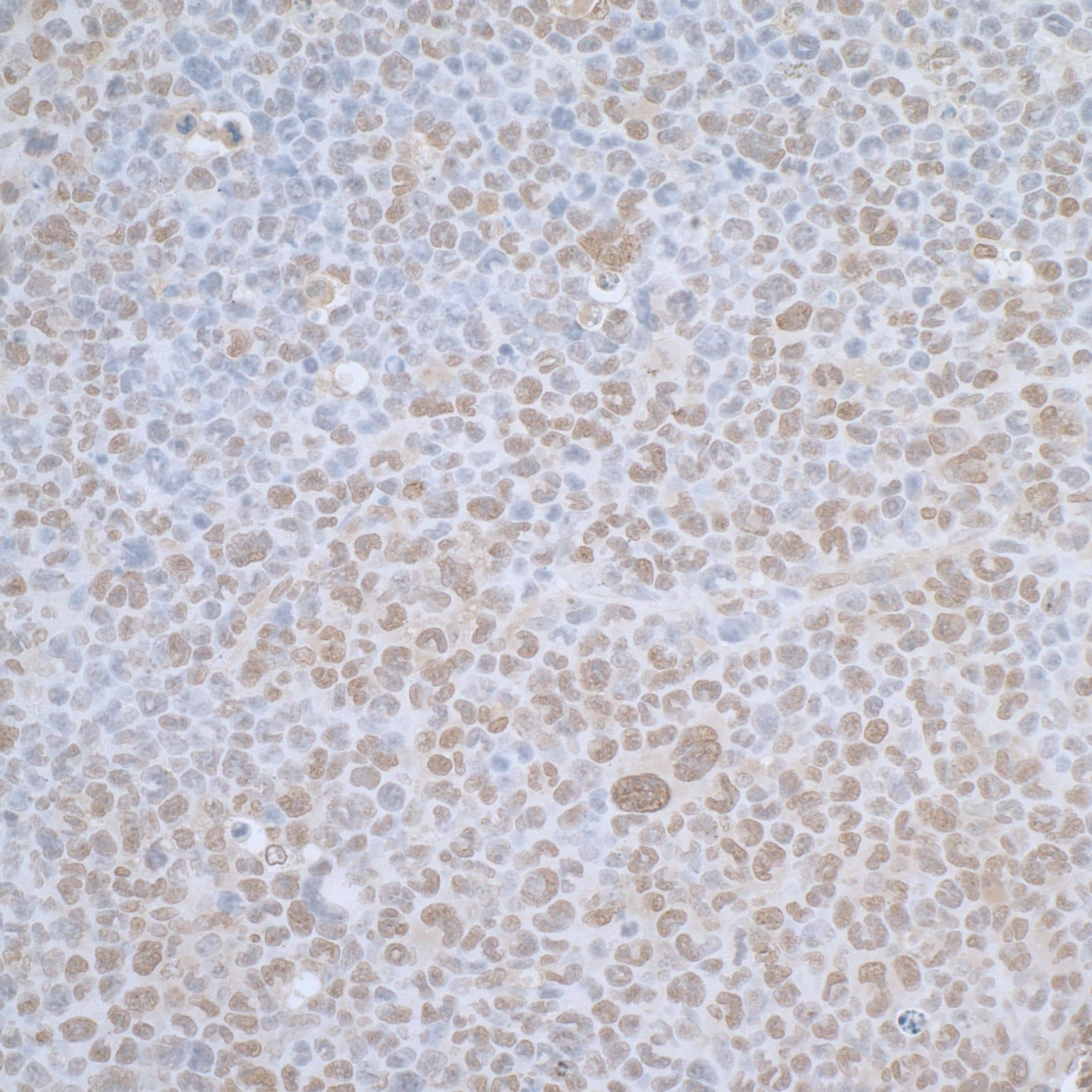 Immunohistochemistry;TCEB1 Antibody[NBP3-29055]Detection of mouse TCEB1 by immunohistochemistry. Sample: FFPE section of mouse plasmacytoma. Antibody: Affinity purified rabbit anti-TCEB1  used at a dilution of 1:1,000 . Detection: DAB