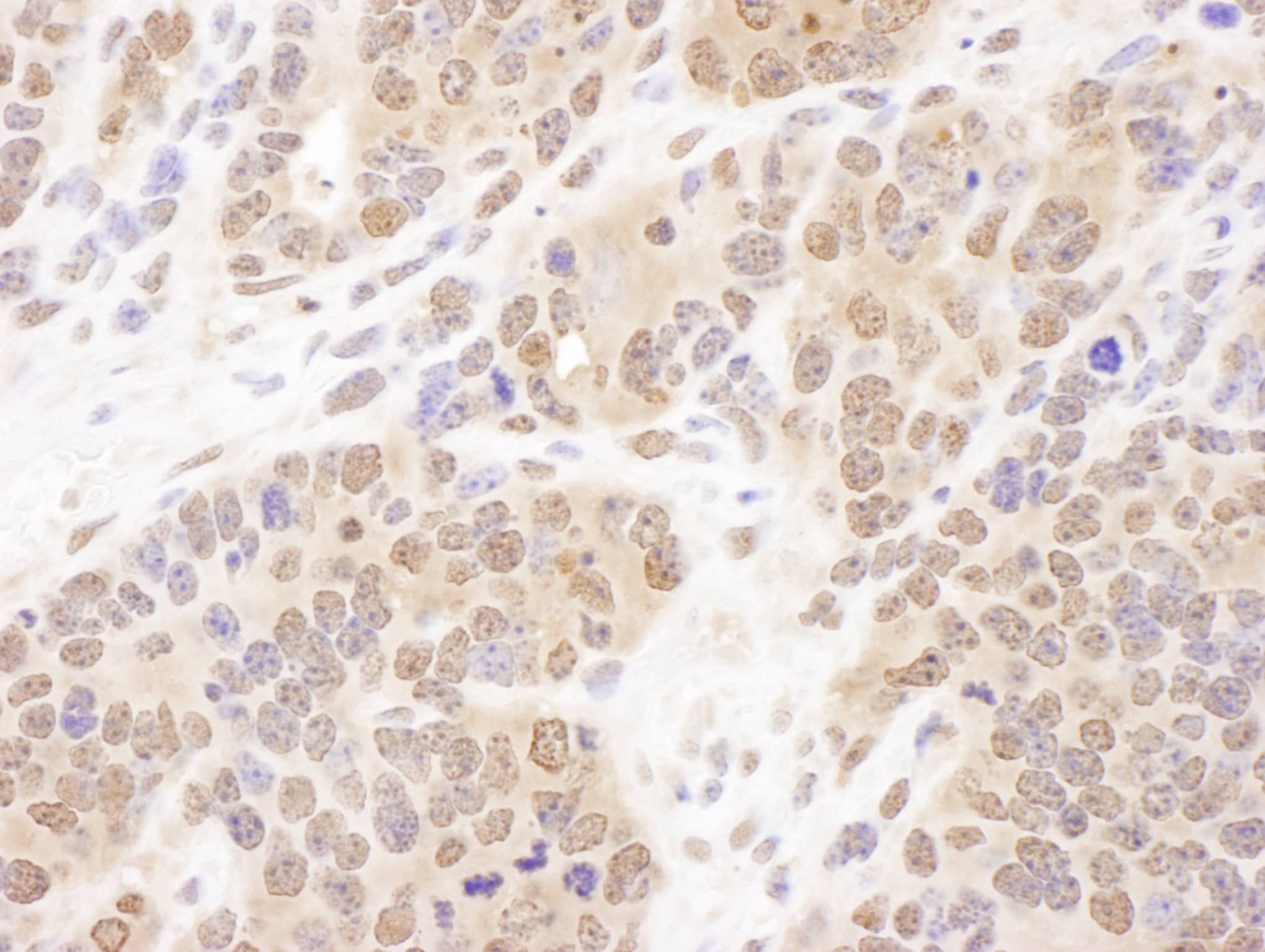 Immunohistochemistry;PSMB7 Antibody[NBP3-29058]Detection of mouse PSMB7 by immunohistochemistry. Sample: FFPE section of mouse teratoma. Antibody: Affinity purified rabbit anti-PSMB7  used at a dilution of 1:1,000 . Detection: DAB