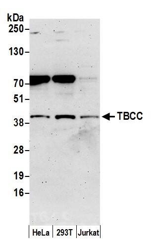 Western Blot:[NBP3-29060]-Detection of human TBCC by western blot. Samples: Whole cell lysate from HeLa, HEK293T, and Jurkat cells prepared using NETN lysis buffer. Antibody: Affinity purified rabbit anti-TBCC antibody used for WB at 0. 1 mg/ml. Detection: Chemiluminescence with an exposure time of 3 minutes.