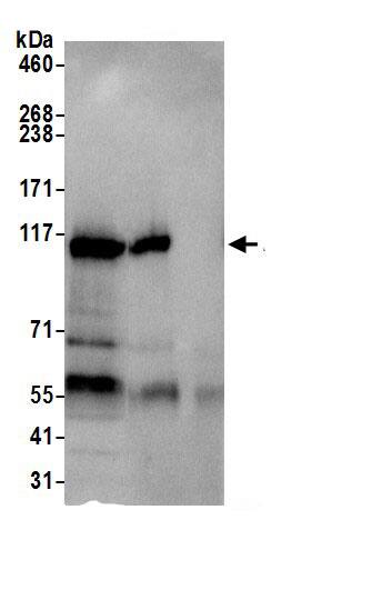 Immunoprecipitation:FAM29A AntibodyNBP3-29064] -Detection of human HAUS6 by western blot of immunoprecipitates. Samples: Whole cell lysate (0.5 or 1.0 mg per IP reaction; 20% of IP loaded) from Jurkat cells prepared using NETN lysis buffer. Antibodies: Affinity purified rabbit anti-HAUS6 antibody NBP3-29064 (lot NBP3-29064-1) used for IP at 6 µg per reaction. HAUS6 was also immunoprecipitated by rabbit anti-HAUS6. For blotting immunoprecipitated HAUS6, NBP3-29064 was used at 1 µg/ml. Detection: Chemiluminescence with an exposure time of 10 seconds.