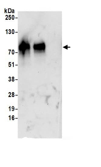 Immunoprecipitation:SLC1A4 AntibodyNBP3-29066] -Detection of human SLC1A4 by western blot of immunoprecipitates. Samples: Whole cell lysate (0.5 or 1.0 mg per IP reaction; 20% of IP loaded) from Jurkat cells prepared using NETN lysis buffer. Antibodies: Affinity purified rabbit anti-SLC1A4 antibody NBP3-29066 (lot NBP3-29066-1) used for IP at 6 µg per reaction. SLC1A4 was also immunoprecipitated by rabbit anti-SLC1A4.. For blotting immunoprecipitated SLC1A4, NBP3-29066 was used at 1 µg/ml. Detection: Chemiluminescence with an exposure time of 30 seconds.