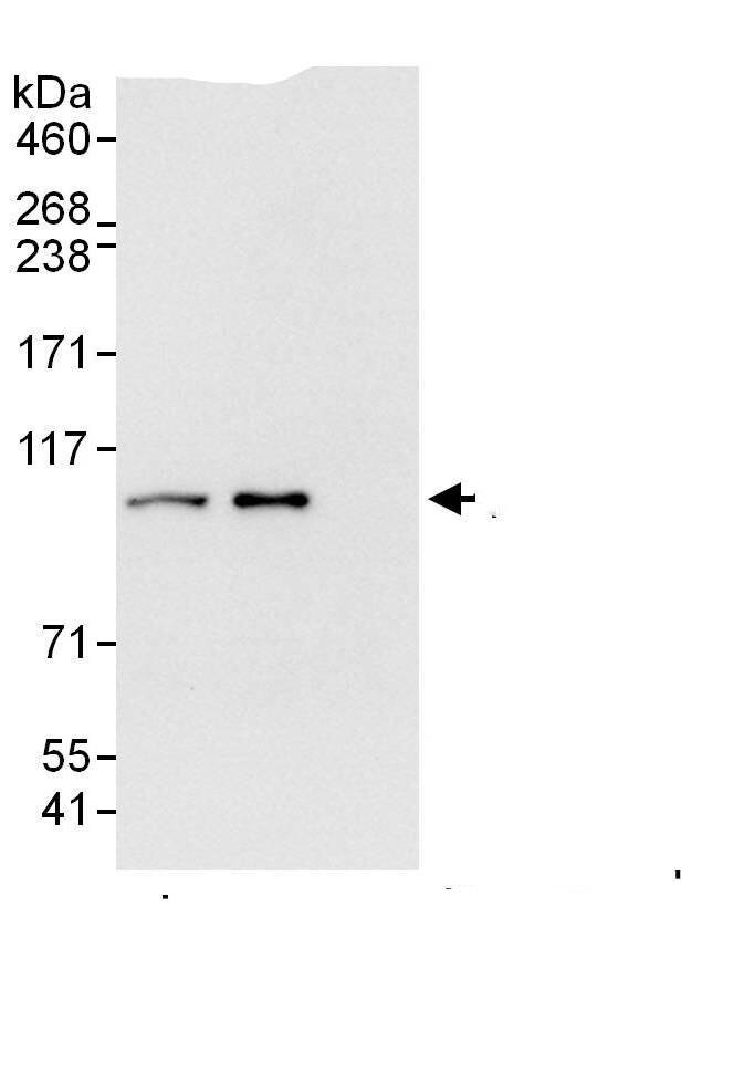 Immunoprecipitation:Proteasome 19S 10B AntibodyNBP3-29069] -Detection of human PCMD2 by western blot of immunoprecipitates. Samples: Whole cell lysate (1 mg for IP; 20% of IP loaded) from HEK293T cells. Antibodies: Affinity purified rabbit anti-PSMD2 antibody NBP3-29069 (lot NBP3-29069-1) used for IP at 6 µg/mg lysate. PSMD2 was also immunoprecipitated by rabbit anti-PSMD2.. For blotting immunoprecipitated PSMD2, NBP3-29069 was used at 1 µg/ml. Detection: Chemiluminescence with an exposure time of 3 seconds.