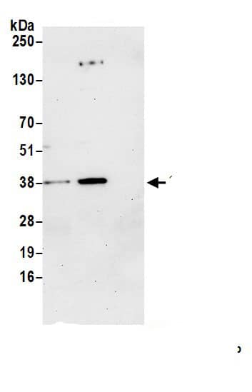 Immunoprecipitation:SGTB AntibodyNBP3-29070] -Detection of human SGTB by western blot of immunoprecipitates. Samples: Whole cell lysate (1.0 mg per IP reaction; 20% of IP loaded) from HeLa cells prepared using NETN lysis buffer. Antibodies: Affinity purified rabbit anti-SGTB antibody (NBP3-29070 lot 1) used for IP at 6 µg per reaction. SGTB was also immunoprecipitated by rabbit anti-SGTB antibody. For blotting immunoprecipitated SGTB, NBP3-29070 was used at 0.4 mg/ml. Detection: Chemiluminescence with an exposure time of 30 seconds.