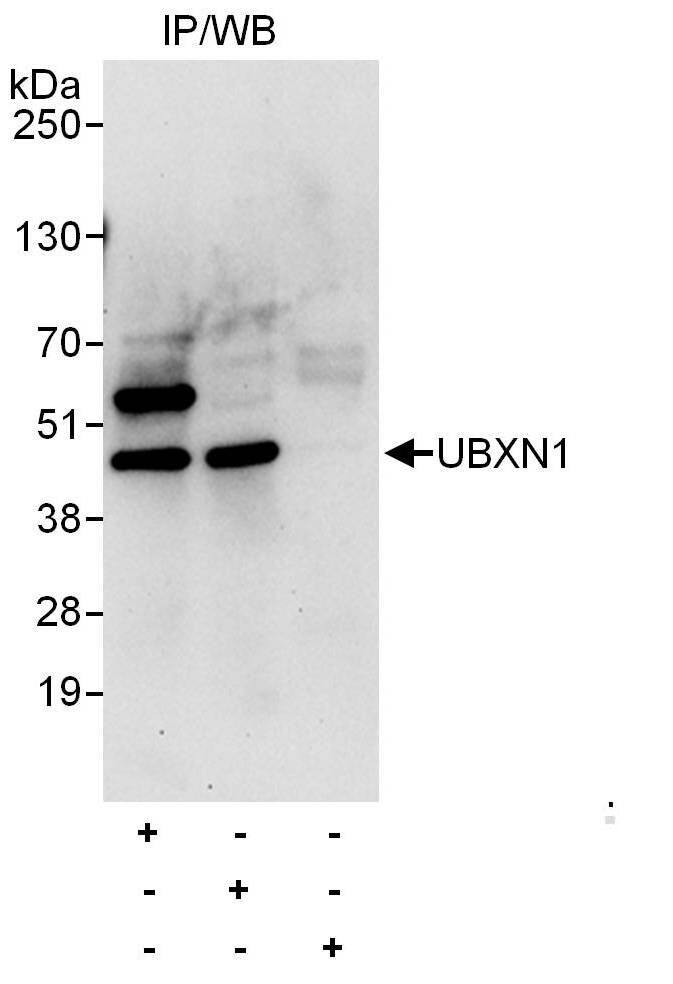 Immunoprecipitation:[NBP3-29073]-Detection of human UBXN1 by western blot of immunoprecipitates. Samples: Whole cell lysate from HeLa cells. Antibodies: Affinity purified rabbit anti-UBXN1 antibody used for IP at 6 µg/mg lysate. UBXN1 was also immunoprecipitated by rabbit anti-UBXN1 antibody , which recognizes an upstream epitope. For blotting immunoprecipitated UBXN1, was used at 0. 4 µg/ml,. Detection: Chemiluminescence with an exposure time of 30 seconds.