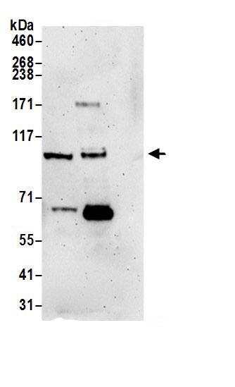 Immunoprecipitation:BRD3 AntibodyNBP3-29074] -Detection of human BRD3 by western blot of immunoprecipitates. Samples: Whole cell lysate (1.0 mg per IP reaction; 20% of IP loaded) from HeLa cells prepared using NETN lysis buffer. Antibodies: Affinity purified rabbit anti-BRD3 antibody NBP3-29074 (lot NBP3-29074-2) used for IP at 3 µg per reaction. BRD3 was also immunoprecipitated by rabbit anti-BRD3.. For blotting immunoprecipitated BRD3, NBP3-29074 was used at 1 µg/ml. Detection: Chemiluminescence with an exposure time of 3 minutes.