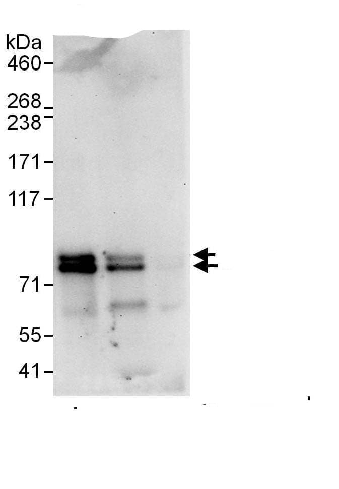 Immunoprecipitation:SSX2IP AntibodyNBP3-29075] -Detection of human SSX2IP by western blot of immunoprecipitates. Samples: Whole cell lysate (1 mg for IP, 20% of IP loaded) from HEK293T cells. Antibodies: Affinity purified rabbit anti-SSX2IP antibody NBP3-29075 used for IP at 6 µg/mg lysate. SSX2IP was also immunoprecipitated by rabbit anti-SSX2IP., which recognizes a downstream epitope. For blotting immunoprecipitated SSX2IP, A303-299A was used at 1 µg/ml. Detection: Chemiluminescence with an exposure time of 30 seconds.