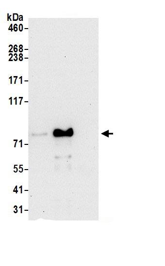 Immunoprecipitation:AFG3L2 AntibodyNBP3-29077] -Detection of human AFG3L2 by western blot of immunoprecipitates. Samples: Whole cell lysate (0.5 or 1.0 mg per IP reaction; 20% of IP loaded) from 293T cells prepared using NETN lysis buffer. Antibodies: Affinity purified rabbit anti-AFG3L2 antibody NBP3-29077 (lot NBP3-29077-1) used for IP at 6 µg per reaction. AFG3L2 was also immunoprecipitated by rabbit anti-AFG3L2 antibody BL21759. For blotting immunoprecipitated AFG3L2, NBP3-29077 was used at 0.4 µg/ml. Detection: Chemiluminescence with an exposure time of 30 seconds.