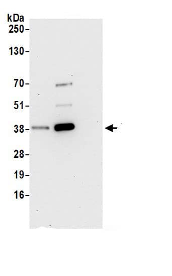 Immunoprecipitation:IDH3B AntibodyNBP3-29078] -Detection of human IDH3B by western blot of immunoprecipitates. Samples: Whole cell lysate (0.5 or 1.0 mg per IP reaction; 20% of IP loaded) from 293T cells prepared using NETN lysis buffer. Antibodies: Affinity purified rabbit anti-IDH3B antibody NBP3-29078 (lot NBP3-29078-1) used for IP at 6 µg per reaction. IDH3B was also immunoprecipitated by rabbit anti-IDH3B.. For blotting immunoprecipitated IDH3B, NBP3-29078 was used at 0.4 µg/ml. Detection: Chemiluminescence with an exposure time of 30 seconds.