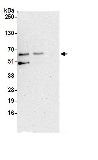 Immunoprecipitation Syntrophin beta 1 Antibody - BSA Free