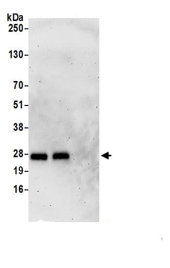 Immunoprecipitation:CRIP2 AntibodyNBP3-29080] -Detection of human CRIP2 by western blot of immunoprecipitates. Samples: Whole cell lysate (0.5 or 1.0 mg per IP reaction; 20% of IP loaded) from HeLa cells prepared using NETN lysis buffer. Antibodies: Affinity purified rabbit anti-CRIP2 antibody (NBP3-29080 lot 1) used for IP at 2 µg per reaction. CRIP2 was also immunoprecipitated by rabbit anti-CRIP2.. For blotting immunoprecipitated CRIP2, NBP3-29080 was used at 0.1 mg/ml. Detection: Chemiluminescence with an exposure time of 3 minutes.