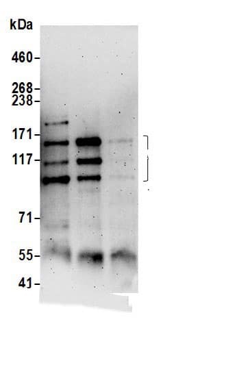 Immunoprecipitation:PEX1 AntibodyNBP3-29083] -Detection of human PEX1 by western blot of immunoprecipitates. Samples: Whole cell lysate (0.5 or 1.0 mg per IP reaction; 20% of IP loaded) from Jurkat cells prepared using NETN lysis buffer. Antibodies: Affinity purified rabbit anti-PEX1 antibody NBP3-29083 (lot NBP3-29083-1) used for IP at 6 µg per reaction. PEX1 was also immunoprecipitated by rabbit anti-PEX1.. For blotting immunoprecipitated PEX1, was used at 1 µg/ml. Detection: Chemiluminescence with an exposure time of 3 minutes.