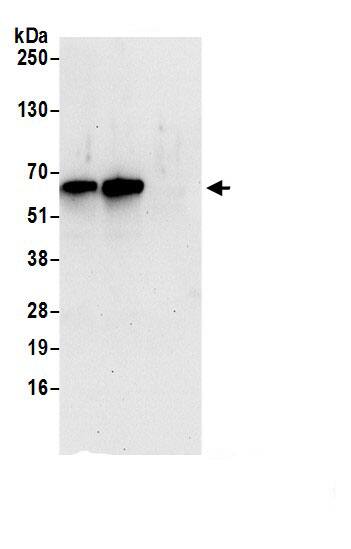 Immunoprecipitation:MON1B AntibodyNBP3-29090] -Detection of human MON1B by western blot of immunoprecipitates. Samples: Whole cell lysate (1.0 mg per IP reaction; 20% of IP loaded) from 293T cells prepared using NETN lysis buffer. Antibodies: Affinity purified rabbit anti-MON1B antibody (NBP3-29090 lot 1) used for IP at 2 µg per reaction. MON1B was also immunoprecipitated by rabbit anti-MON1B.. For blotting immunoprecipitated MON1B, NBP3-29090 was used at 0.1 mg/ml. Detection: Chemiluminescence with an exposure time of 30 seconds.