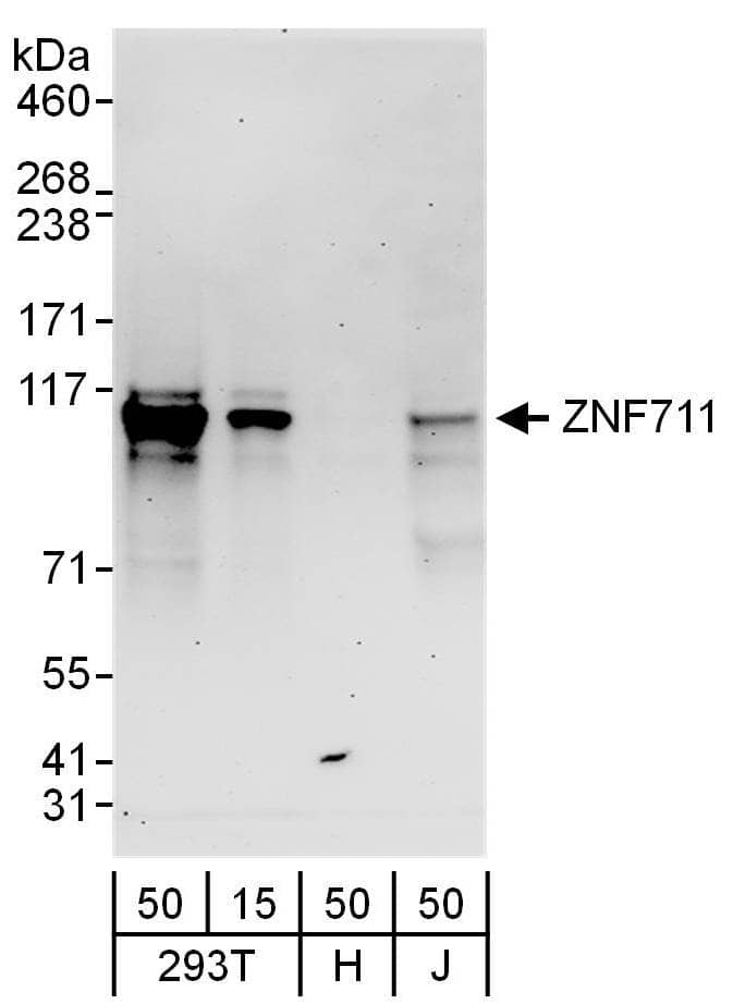 Western Blot:[NBP3-29092]-Detection of human ZNF711 by western blot. Samples: Whole cell lysate from HEK293T , HeLa and Jurkat cells. Antibodies: Affinity purified rabbit anti-ZNF711 antibody used for WB at 0. 1 µg/ml. Detection: Chemiluminescence with an exposure time of 3 minutes.