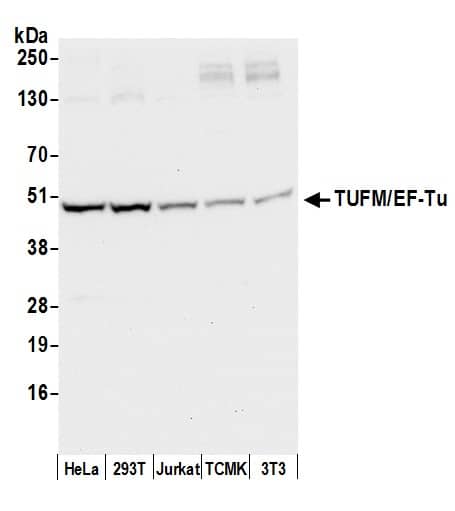 Western Blot:[NBP3-29094]-Detection of human and mouse TUFM/EF-Tu by western blot. Samples: Whole cell lysate from HeLa, HEK293T, Jurkat, mouse TCMK-1, and mouse NIH 3T3 cells prepared using NETN lysis buffer. Antibody: Affinity purified rabbit anti-TUFM/EF-Tu antibody used for WB at 0. 1 µg/ml. Detection: Chemiluminescence with an exposure time of 10 seconds.