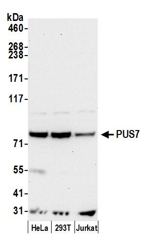Western Blot PUS7 Antibody - BSA Free