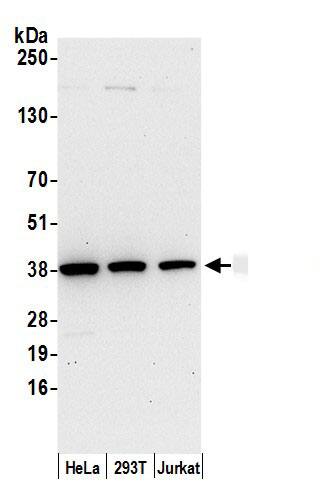 Western Blot:[NBP3-29097]-Detection of human AKR1B1 by western blot. Samples: Whole cell lysate from HeLa, HEK293T, and Jurkat cells prepared using NETN lysis buffer. Antibody: Affinity purified rabbit anti-AKR1B1 antibody used for WB at 0. 1 µg/ml. Detection: Chemiluminescence with an exposure time of 30 seconds.