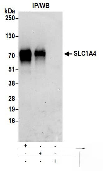 Immunoprecipitation:[NBP3-29100]-Detection of human SLC1A4 by western blot of immunoprecipitates. Samples: Whole cell lysate from Jurkat cells prepared using NETN lysis buffer. Antibodies: Affinity purified rabbit anti-SLC1A4 antibody used for IP at 6 µg per reaction. SLC1A4 was also immunoprecipitated by rabbit anti-SLC1A4 antibody. For blotting immunoprecipitated SLC1A4, was used at 1 µg/ml. Detection: Chemiluminescence with an exposure time of 30 seconds.