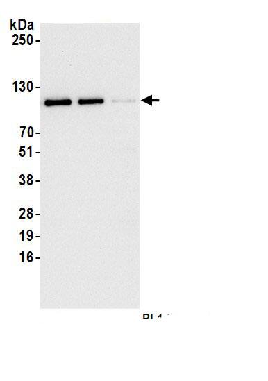 Immunoprecipitation:Drebrin 1 AntibodyNBP3-29101] -Detection of human Drebrin by western blot of immunoprecipitates. Samples: Whole cell lysate (1.0 mg per IP reaction; 20% of IP loaded) from HeLa cells prepared using NETN lysis buffer. Antibodies: Affinity purified rabbit anti-Drebrin antibody (NBP3-29101 lot 1) used for IP at 1 µg per reaction. Drebrin was also immunoprecipitated by a second.inst a different epitope of Drebrin. For blotting immunoprecipitated Drebrin, NBP3-29101 was used at 0.04 µg/ml. Detection: Chemiluminescence with an exposure time of 3 seconds.