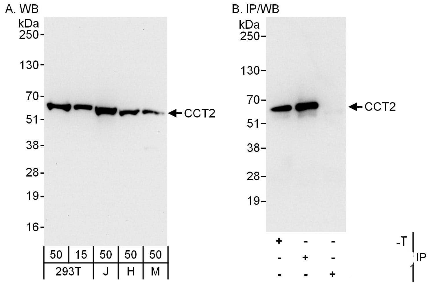 Western Blot:[NBP3-29102]-Detection of human and mouse CCT2 by western blot and immunoprecipitation. Samples: Whole cell lysate from HEK293T , Jurkat , HeLa and mouse NIH 3T3 cells. Antibodies: Affinity purified rabbit anti-CCT2 antibody used for WB at 0. 04 µg/ml and 0. 4 µg/ml and used for IP at 6 µg/mg lysate. CCT2 was also immunoprecipitated by rabbit anti-CCT2 antibody , which recognizes an upstream epitope. Detection: Chemiluminescence with exposure times of 10 seconds and 3 seconds.