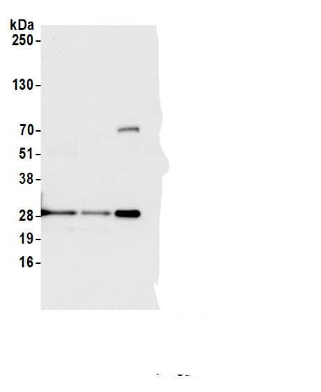 Immunoprecipitation:D4-GDI/RhoGDI2 AntibodyNBP3-29104] -Detection of human ARHGDIB/D4-GDI by western blot of immunoprecipitates. Samples: Whole cell lysate (1.0 mg per IP reaction; 20% of IP loaded) from Jurkat cells prepared using NETN lysis buffer. Antibodies: Affinity purified rabbit anti-ARHGDIB/D4-GDI antibody (NBP3-29104 lot 2) used for IP at 6 µg per reaction. ARHGDIB/D4-GDI was also immunoprecipitated by a previous lot of this antibody (NBP3-29104 lot 1) and rabbit anti-ARHGDIB/D4-GDI antibody Brother. For blotting immunoprecipitated ARHGDIB/D4-GDI, NBP3-29104 was used at 0.1 µg/ml. Detection: Chemiluminescence with an exposure time of 3 seconds.