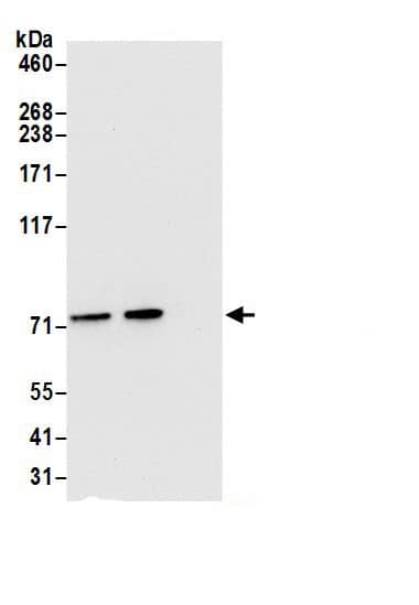 Immunoprecipitation:TRAP1 AntibodyNBP3-29105] -Detection of human TRAP1/HSP75 by western blot of immunoprecipitates. Samples: Whole cell lysate (0.5 or 1.0 mg per IP reaction; 20% of IP loaded) from 293T cells prepared using NETN lysis buffer. Antibodies: Affinity purified rabbit anti-TRAP1/HSP75 antibody NBP3-29105 (lot NBP3-29105-1) used for IP at 6 µg per reaction. TRAP1/HSP75 was also immunoprecipitated by rabbit anti-TRAP1/HSP75.. For blotting immunoprecipitated TRAP1/HSP75, NBP3-29105 was used at 0.4 µg/ml. Detection: Chemiluminescence with an exposure time of 10 seconds.