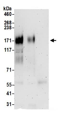 Immunoprecipitation:MRP1 AntibodyNBP3-29106] -Detection of human MRP1 by western blot of immunoprecipitates. Samples: Whole cell lysate (1 mg for IP; 20% of IP loaded) prepared using RIPA buffer from Jurkat cells. Antibodies: Affinity purified rabbit anti-MRP1 antibody NBP3-29106 (lot NBP3-29106-1) used for IP at 6 µg per reaction. MRP1 was also immunoprecipitated by rabbit anti-MRP1 antibody BL15927. For blotting immunoprecipitated MRP1, NBP3-29106 was used at 1 µg/ml. Detection: Chemiluminescence with an exposure time of 3 minutes.