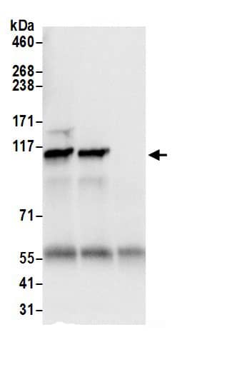 Immunoprecipitation:SEC24C AntibodyNBP3-29107] -Detection of human SEC24C by western blot of immunoprecipitates. Samples: Whole cell lysate (0.5 or 1.0 mg per IP reaction; 20% of IP loaded) from 293T cells prepared using NETN lysis buffer. Antibodies: Affinity purified rabbit anti-SEC24C antibody NBP3-29107 (lot NBP3-29107-1) used for IP at 6 µg per reaction. SEC24C was also immunoprecipitated by rabbit anti-SEC24C.. For blotting immunoprecipitated SEC24C, A304-759A was used at 0.4 µg/ml. Detection: Chemiluminescence with an exposure time of 1 second.