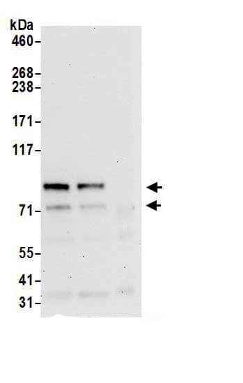 Immunoprecipitation:RUFY1 AntibodyNBP3-29108] -Detection of human RUFY1 by western blot of immunoprecipitates. Samples: Whole cell lysate (0.5 or 1.0 mg per IP reaction; 20% of IP loaded) from HeLa cells prepared using NETN lysis buffer. Antibodies: Affinity purified rabbit anti-RUFY1 antibody NBP3-29108 (lot NBP3-29108-1) used for IP at 6 µg per reaction. RUFY1 was also immunoprecipitated by rabbit anti-RUFY1.. For blotting immunoprecipitated RUFY1, NBP3-29108 was used at 1 µg/ml. Detection: Chemiluminescence with an exposure time of 30 seconds.