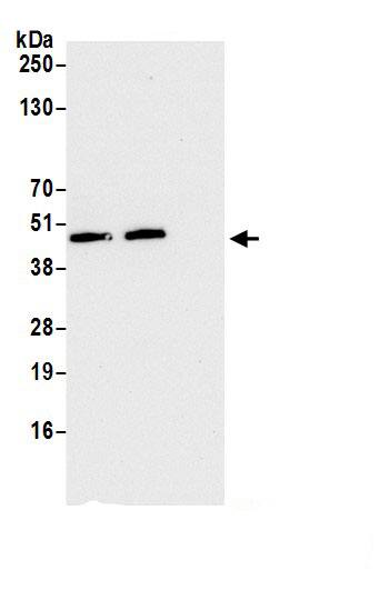 Immunoprecipitation:FAM105B/OTULIN AntibodyNBP3-29109] -Detection of human OTULIN by western blot of immunoprecipitates. Samples: Whole cell lysate (1.0 mg per IP reaction; 20% of IP loaded) from HeLa cells prepared using NETN lysis buffer. Antibodies: Affinity purified rabbit anti-OTULIN antibody (NBP3-29109 lot 1) used for IP at 2 µg per reaction. OTULIN was also immunoprecipitated by rabbit anti-OTULIN.. For blotting immunoprecipitated OTULIN, NBP3-29109 was used at 0.1 mg/ml. Detection: Chemiluminescence with an exposure time of 10 seconds.