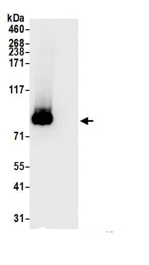 Immunoprecipitation:HAUS5 AntibodyNBP3-29110] -Detection of human HAUS5 by western blot of immunoprecipitates. Samples: Whole cell lysate (1.0 mg per IP reaction; 20% of IP loaded) from HeLa cells prepared using NETN lysis buffer. Antibodies: Affinity purified rabbit anti-HAUS5 antibody (NBP3-29110 lot 1) used for IP at 1 µg per reaction. For blotting immunoprecipitated HAUS5, NBP3-29110 was used at 0.04 mg/ml. Detection: Chemiluminescence with an exposure time of 3 seconds.