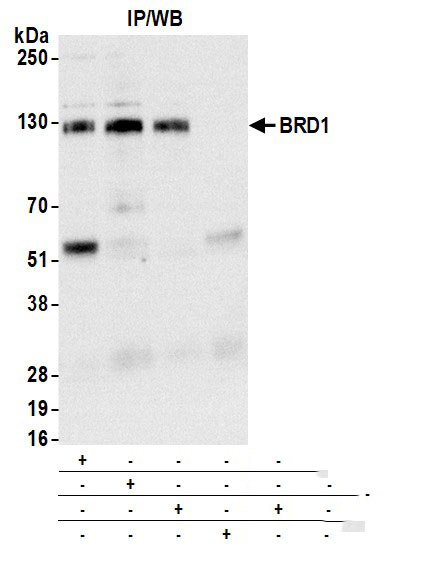 Immunoprecipitation:[NBP3-29111]-Detection of human BRD1 by western blot of immunoprecipitates. Samples: Whole cell lysate from HeLa cells prepared using NETN lysis buffer. Antibodies: Affinity purified rabbit anti-BRD1 antibody used for IP at 6 µg per reaction. BRD1 was also immunoprecipitated by a previous lot of this antibody and a second antibody against a different epitope of BRD1. For blotting immunoprecipitated BRD1, was used at 0. 04 µg/ml. Detection: Chemiluminescence with an exposure time of 30 seconds.