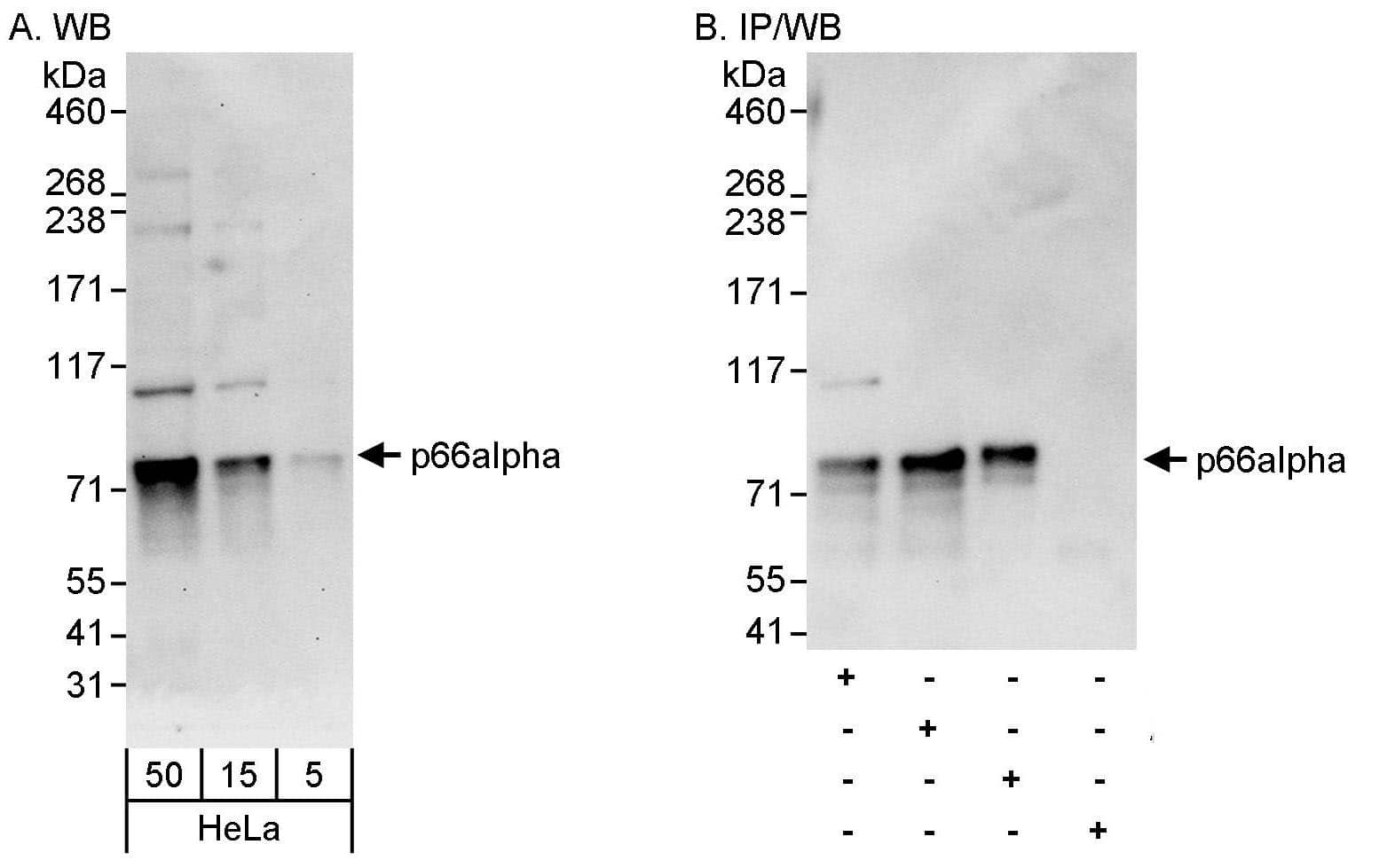 Western Blot:[NBP3-29112]-Detection of human p66alpha by western blot and immunoprecipitation. Samples: Whole cell lysate from HeLa cells. Antibodies: Affinity purified rabbit antibody used for WB at 0. 04 µg/ml and 1 µg/ml and used for IP at 10 µg/mg lysate. p66alpha was also immunoprecipitated by rabbit antibodies and , which recognize downstream epitopes. Detection: Chemiluminescence with exposure times of 30 seconds and 10 seconds.