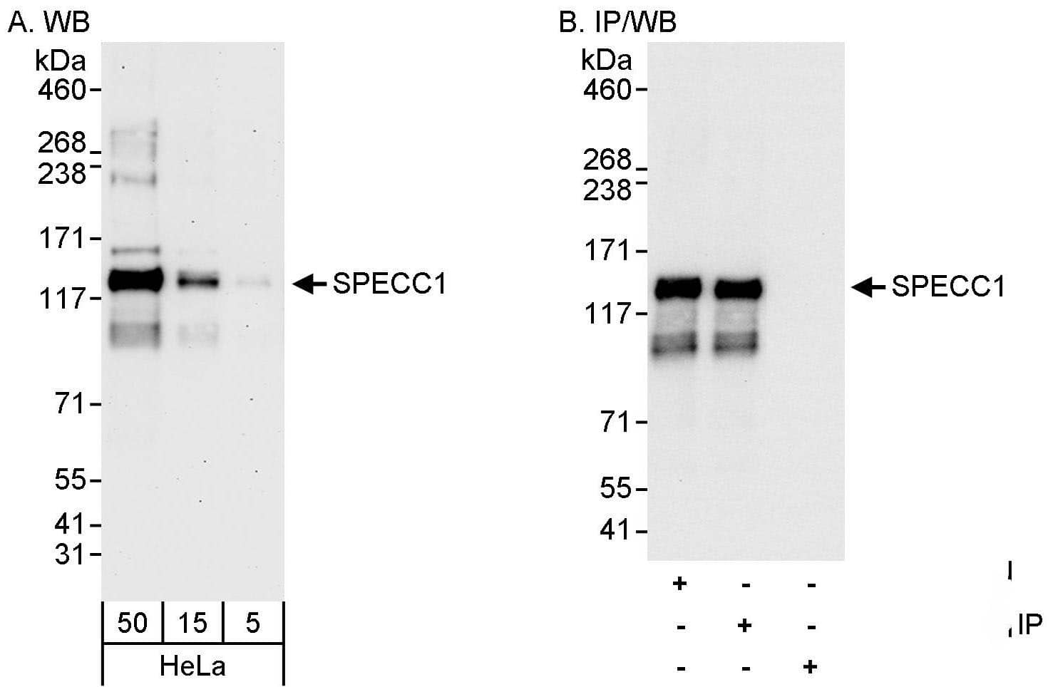 Western Blot:[NBP3-29113]-Detection of human SPECC1 by western blot and immunoprecipitation. Samples: Whole cell lysate from HeLa cells. Antibodies: Affinity purified rabbit anti-SPECC1 antibody used for WB at 0. 04 µg/ml and 0. 4 µg/ml and used for IP at 3 µg/mg lysate. SPECC1 was also immunoprecipitated by rabbit anti-SPECC1 antibody , which recognizes a downstream epitope. Detection: Chemiluminescence with exposure times of 3 minutes and 10 seconds.